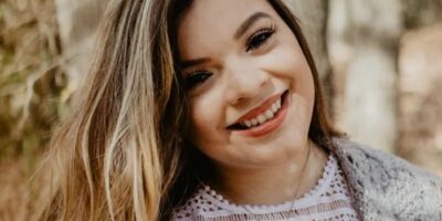 Living Lively Learning How to Live Positively alongside Vitiligo