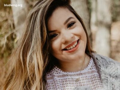 Living Lively Learning How to Live Positively alongside Vitiligo