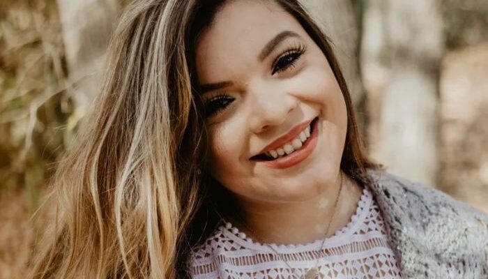 Living Lively Learning How to Live Positively alongside Vitiligo